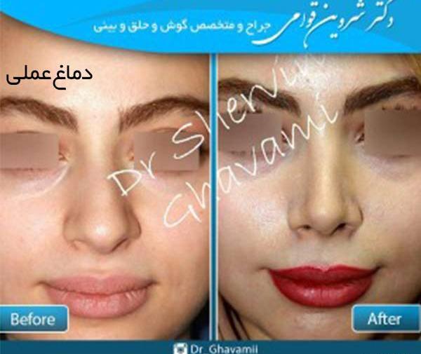 عکس مدل های دماغ عملی