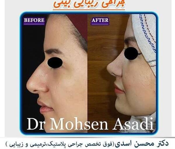 عکس مدل های دماغ عملی