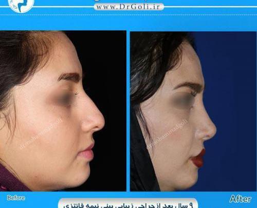 عکس مدل های دماغ عملی