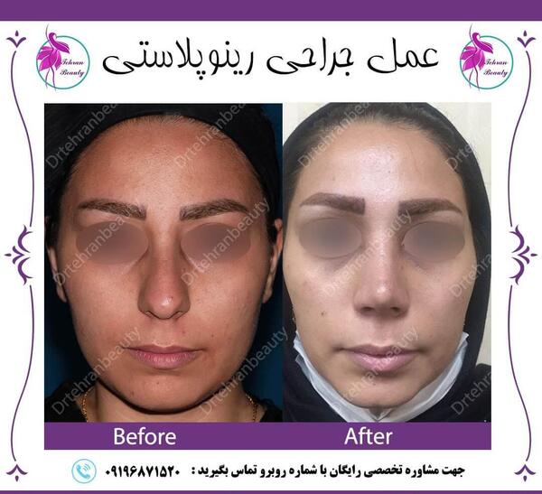 عکس مدل های دماغ عملی