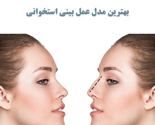 عکس مدل های دماغ عملی