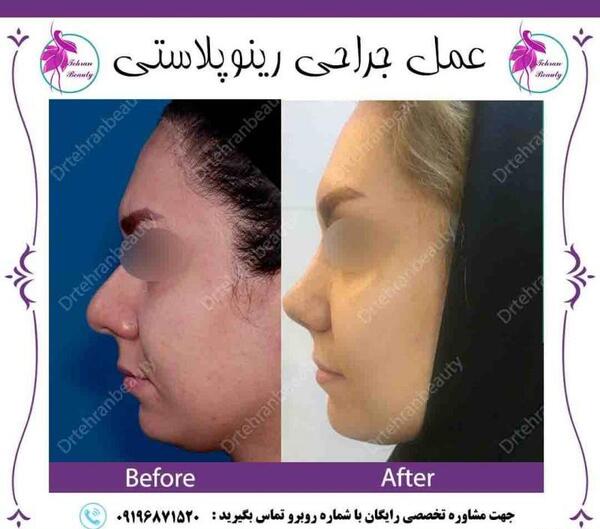 عکس مدل های دماغ عملی