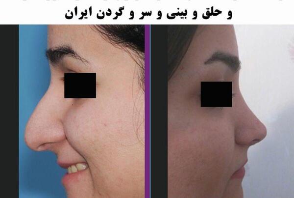 عکس مدل های دماغ عملی