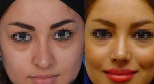 عکس مدل های دماغ عملی