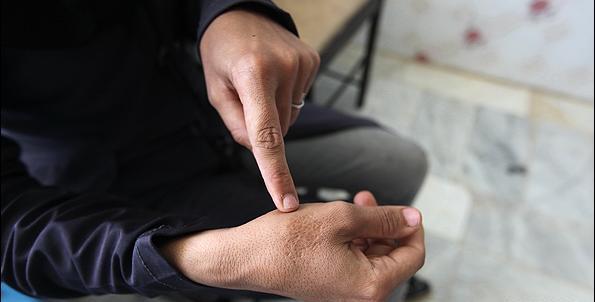 عکس و تصویر گزیدگی سالک