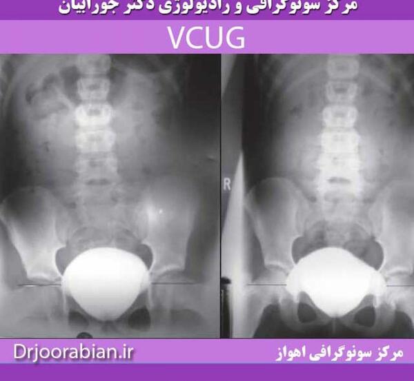 عکس وی سی یو جی چیست