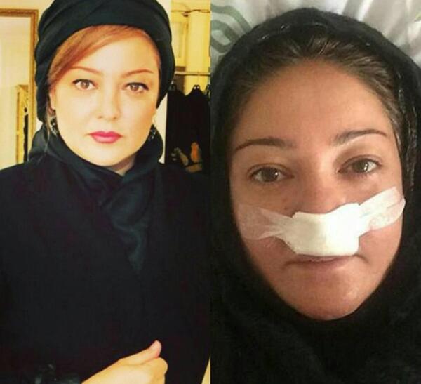 عکس های جوانی رزیتا غفاری
