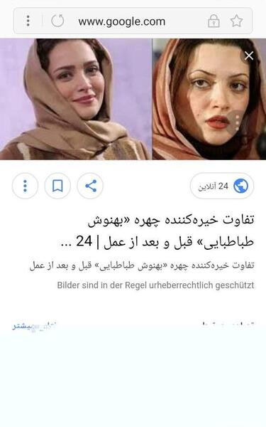 عکس بهنوش طباطبایی قبل عمل بینی
