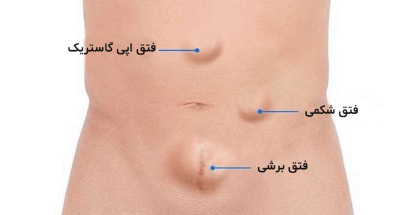 عکس داخل شکم سمت راست
