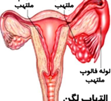 عکس داخل شکم سمت راست