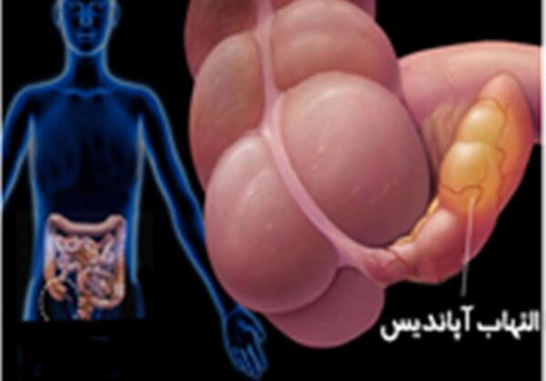 عکس داخل شکم سمت راست