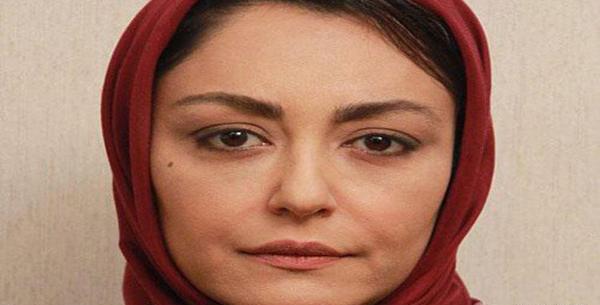 عکس شقایق فراهانی قبل از عمل زیبایی