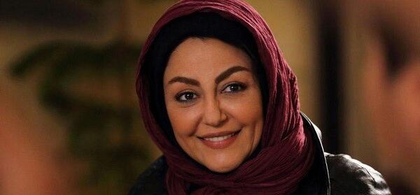 عکس شقایق فراهانی قبل از عمل زیبایی