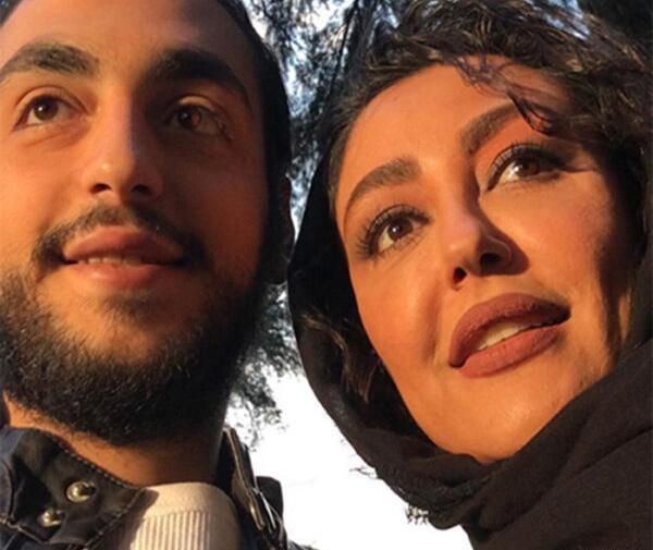 عکس شقایق فراهانی قبل از عمل زیبایی