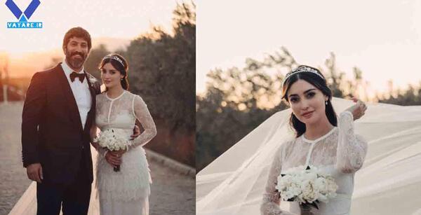 عکس مژگان در سریال چوکوروا قبل از عمل