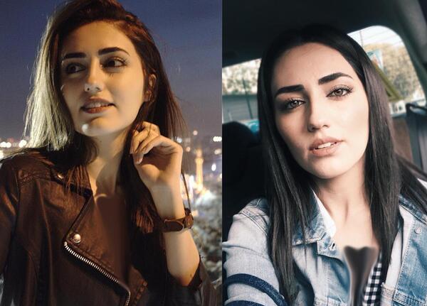 عکس مژگان در سریال چوکوروا قبل از عمل