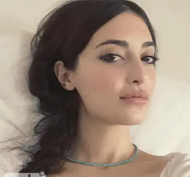 عکس مژگان در سریال چوکوروا قبل از عمل