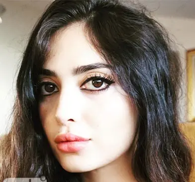 عکس مژگان در سریال چوکوروا قبل از عمل