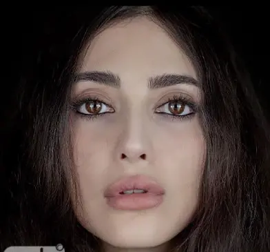 عکس مژگان در سریال چوکوروا قبل از عمل