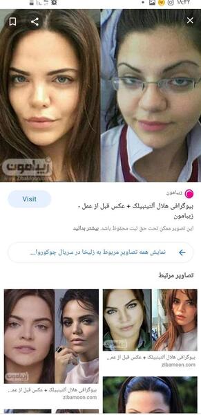عکس مژگان در سریال چوکوروا قبل از عمل