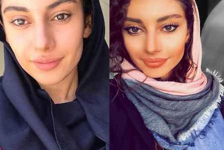 عکس ترلان پروانه بدون آرایش