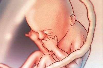 عکس واقعی جنین 20 هفته