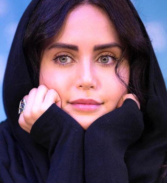 عکس های صورت الناز شاکردوست
