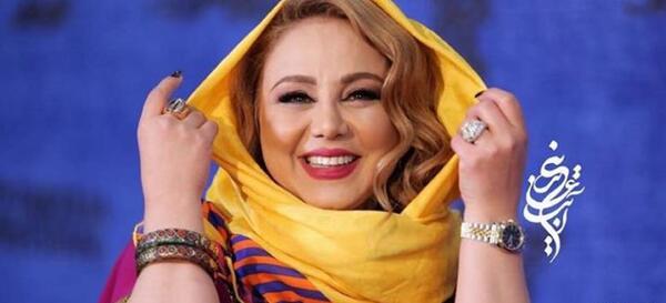 عکس صورت بهنوش بختیاری