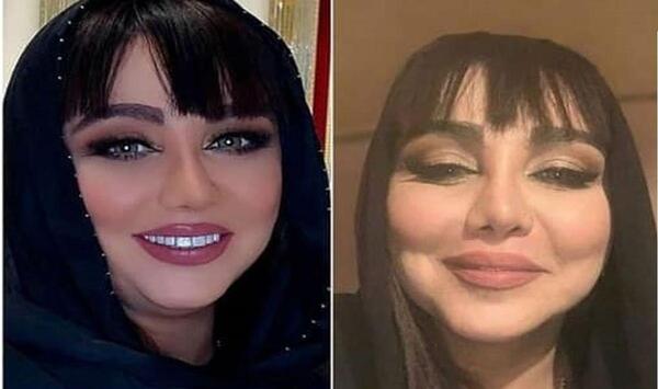 عکس صورت بهنوش بختیاری