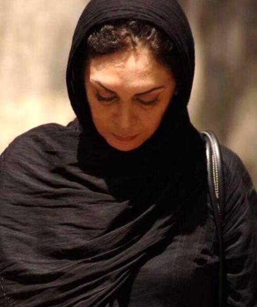 عکس افسانه بایگان قبل عمل