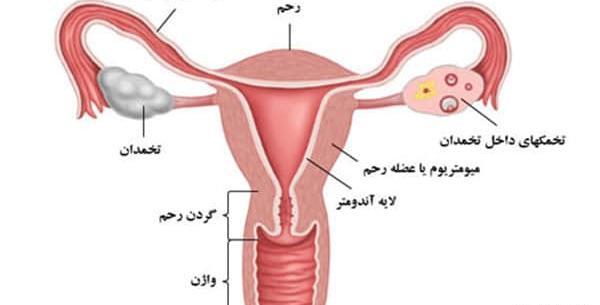 عکس و تصویر تخمک آزاد شده در سونوگرافی