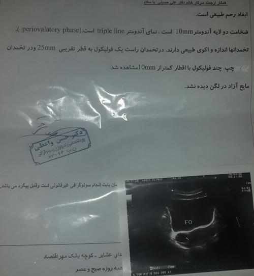 عکس و تصویر تخمک آزاد شده در سونوگرافی