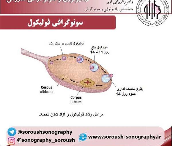 عکس و تصویر تخمک آزاد شده در سونوگرافی