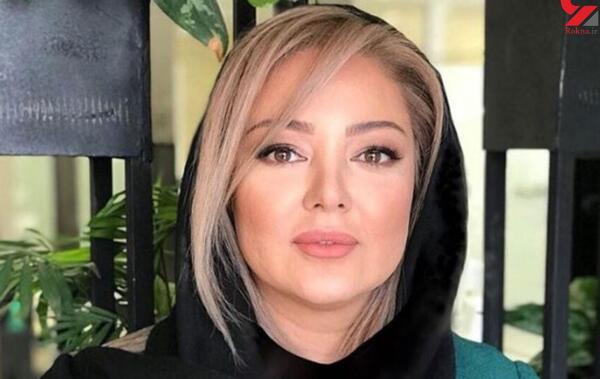 عکس رزیتا غفاری بعد از عمل بینی