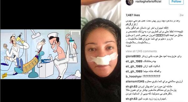 عکس رزیتا غفاری بعد از عمل بینی