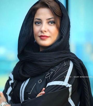 عکس تصاویر طناز طباطبایی قبل از عمل زیبایی