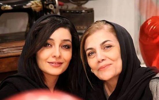 عکس ساره بیات قبل عمل