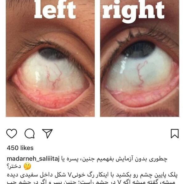 عکس حرف وی در چشم زن باردار