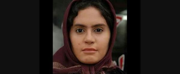 عکس الناز حبیبی قبل از عمل و بعد از عمل