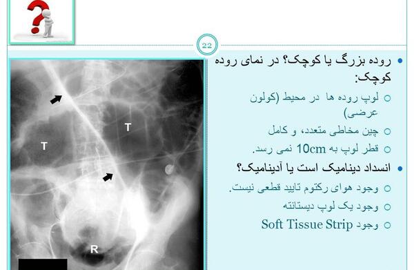 عکس ایستاده شکم