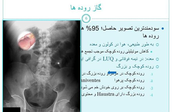 عکس ایستاده شکم