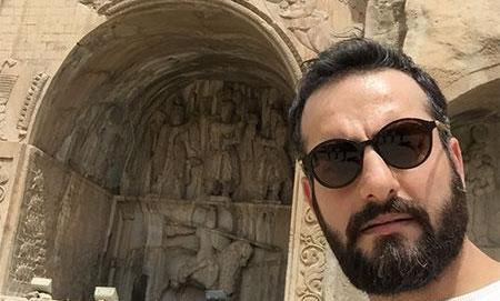 عکس حامد کمیلی قبل عمل