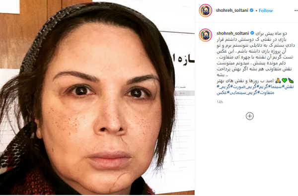 عکس قبل از عمل شهره سلطانی