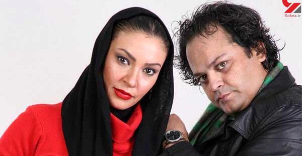 عکس زیبا بروفه بعد از عمل