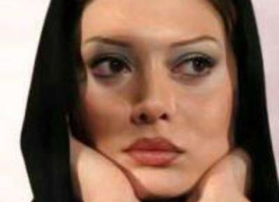 عکس عاطفه رضوی قبل عمل بینی