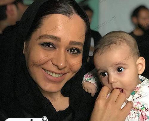 عکس سانیا سالاری قبل از عمل بینی