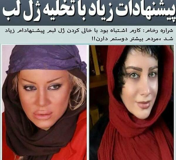 عکس جدید شراره رخام بعد از تخلیه ژل