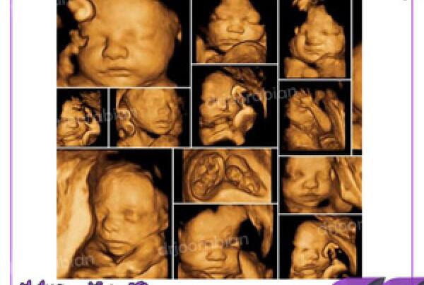 عکس سه بعدی جنین