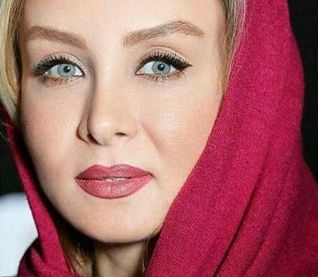 عکس حدیث فولادوند قبل از عمل