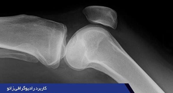 عکس ایستاده زانو